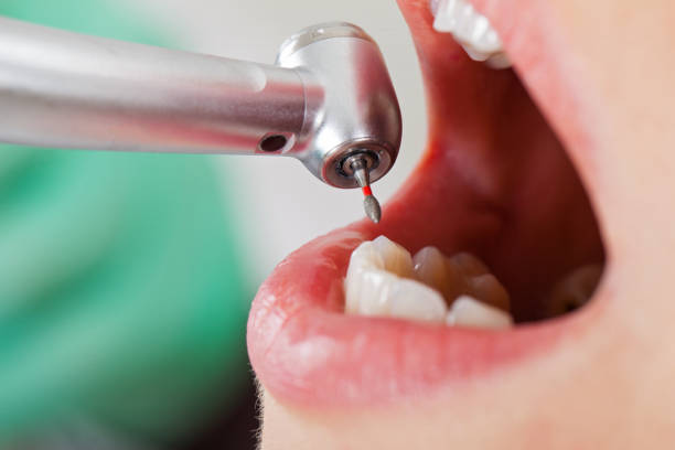 Best Urgent Dental Care for Toothaches in Woodbine, GA